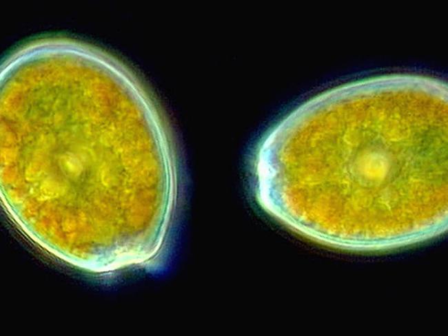 Prorocentrum, an unusual dinoflagellate with two large valves, is often marked with pores which can be used in the identification of species. Picture: Bob Andersen and DJ Patterson, Census of Marine Life/AP