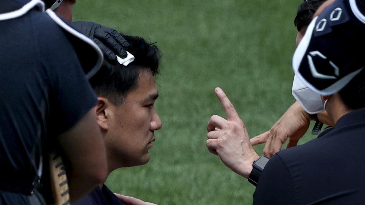 New York Yankees pitcher Masahiro Tanaka was concussed after being struck in the head by a brutal line drive.