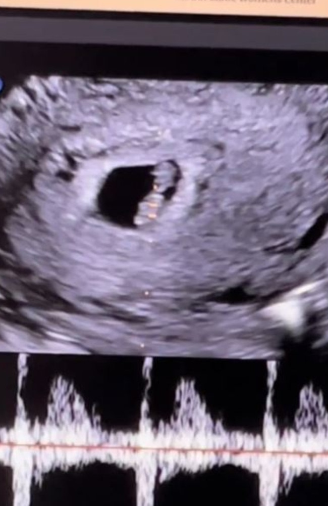 They are having a baby with a surrogate. Picture: TikTok/@oliver6060