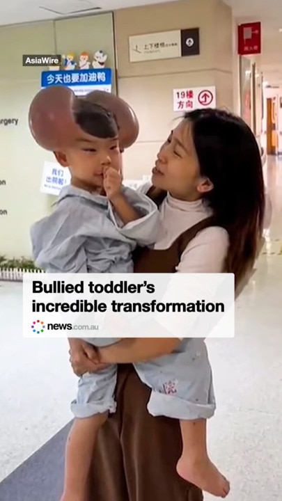 Bullied toddler’s incredible transformation