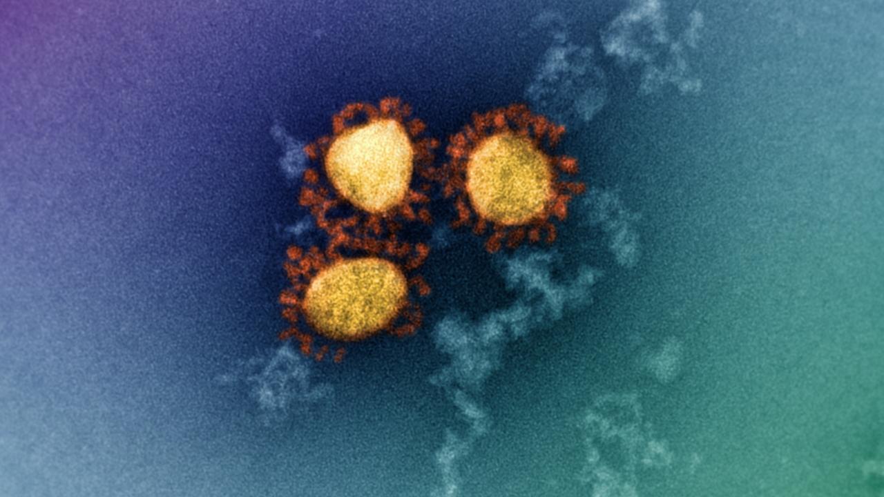 The Omicron variant is believed to be milder than Delta. Picture: Dr Jason A. Roberts, Head, Electron Microscopy and Structural Virology, Doherty Institute