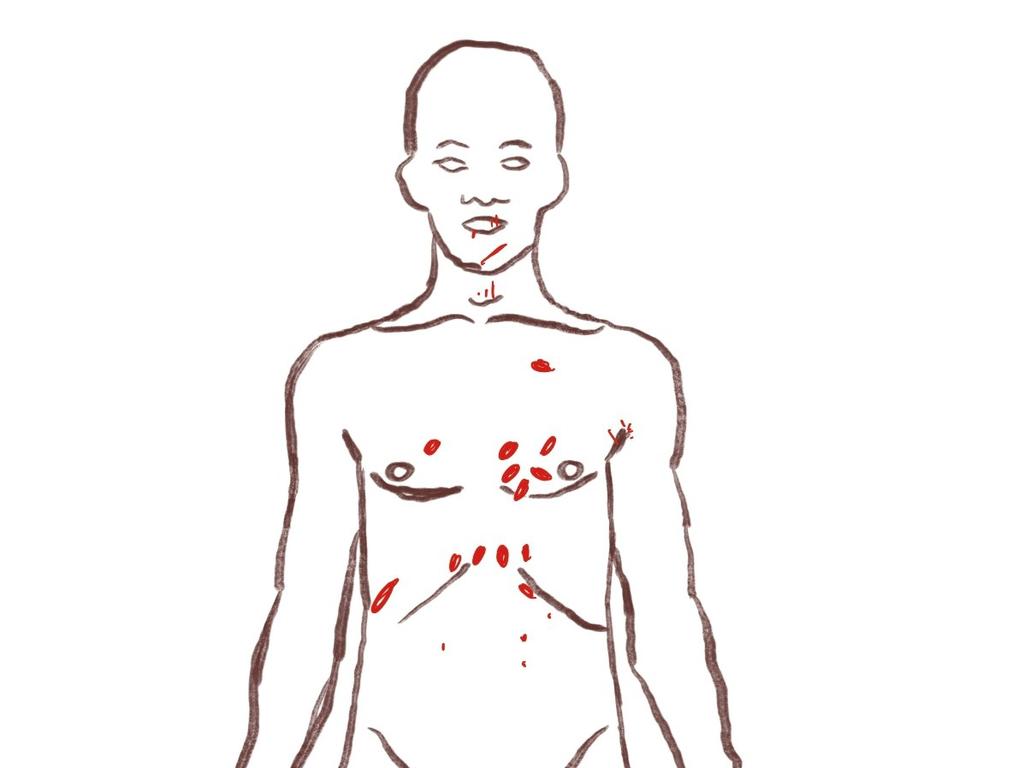 Diagram outlining roughly where the stab wounds were located on Darren Ints's body as per observations of photographs shown in court during accused murderer Jake Scott Ashman's trial.