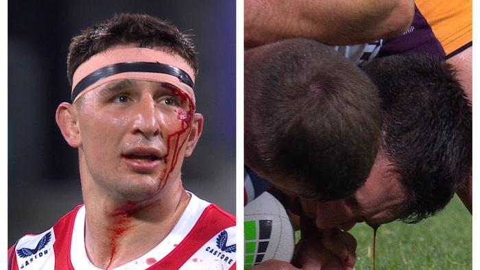 Victor Radley copped a bruising head knock.