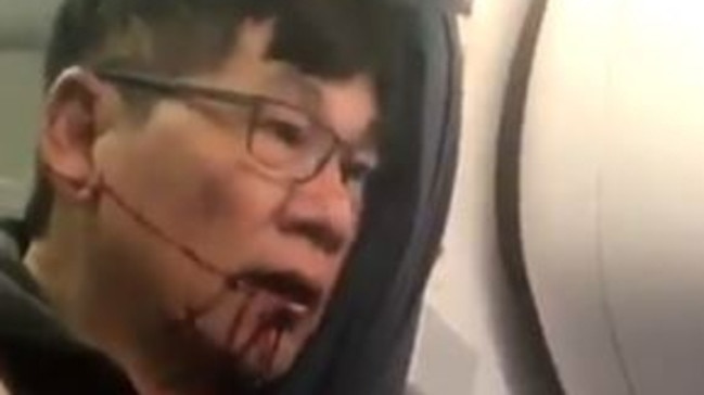 Image made from a video provided by Audra D. Bridges shows the man being removed from a United Airlines flight in Chicago. Picture: Twitter/kaylyn_davis