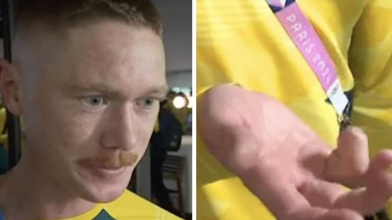 Matthew Dawson is all set to represent the Australian men’s hockey team — the Kookaburras — at the Paris 2024 Olympics after he opted to amputate part of his right ring finger. Picture: Today Show