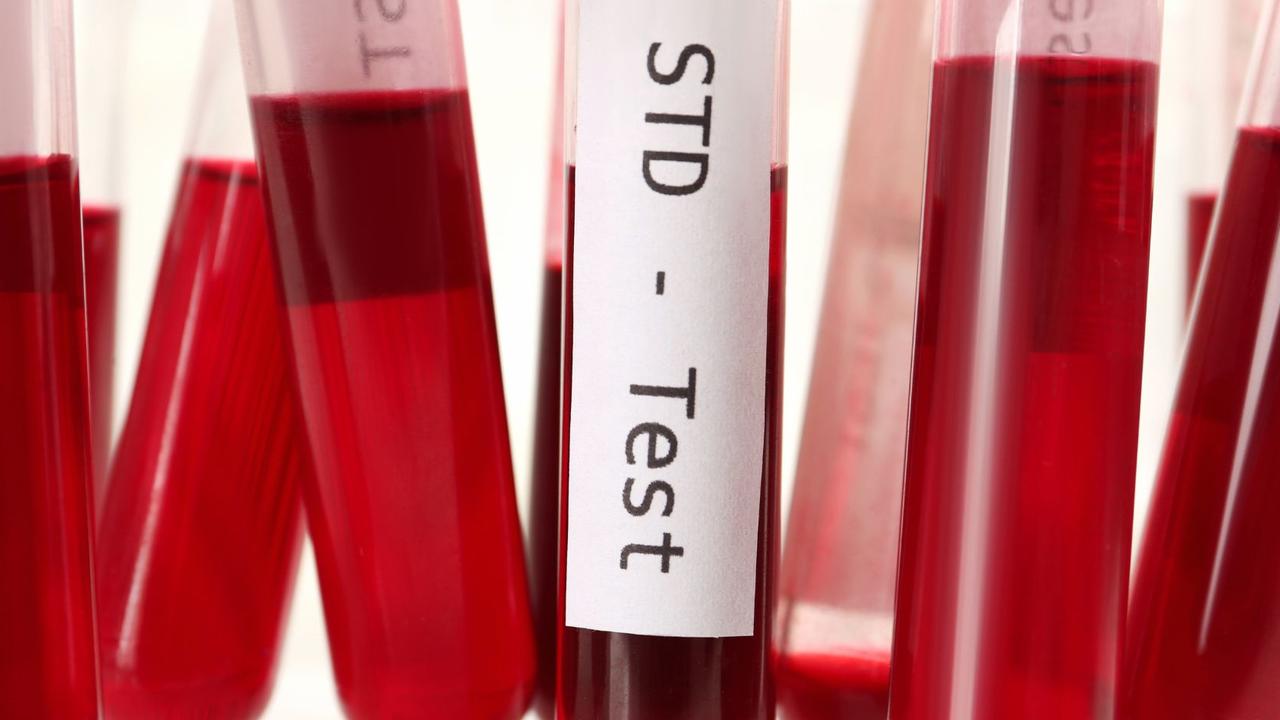 Sexually transmitted infections are rising due to people not using condoms and lack of testing.