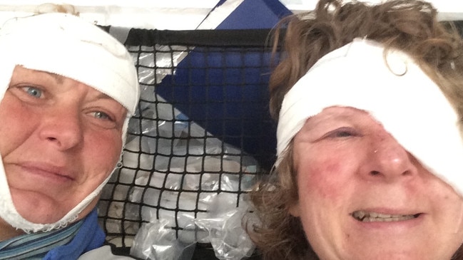 Wendy Tuck, left, with a fellow crewmate after suffering a head injury at sea. Picture; Supplied.