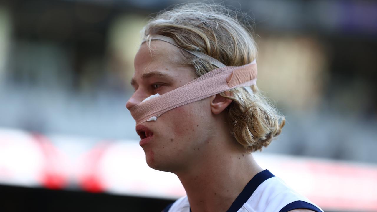 The young Cat suffered the injury in the club’s win over Essendon. (Photo by Robert Cianflone/Getty Images)