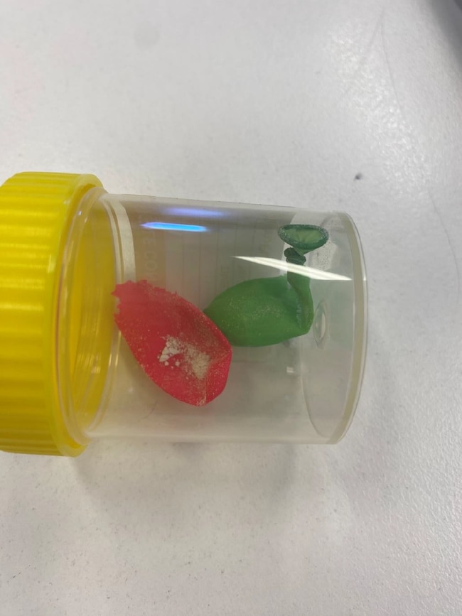 Adelaide Womens Prison body scan detects contraband balloons with powder found on prisoner. Picture: Supplied.