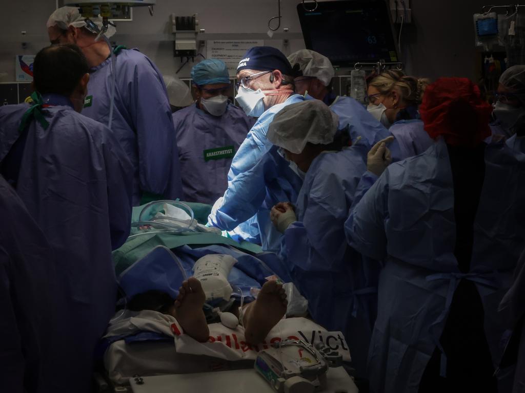 Professor Mark Fitzgerald massages a patient’s heart. Picture: David Caird