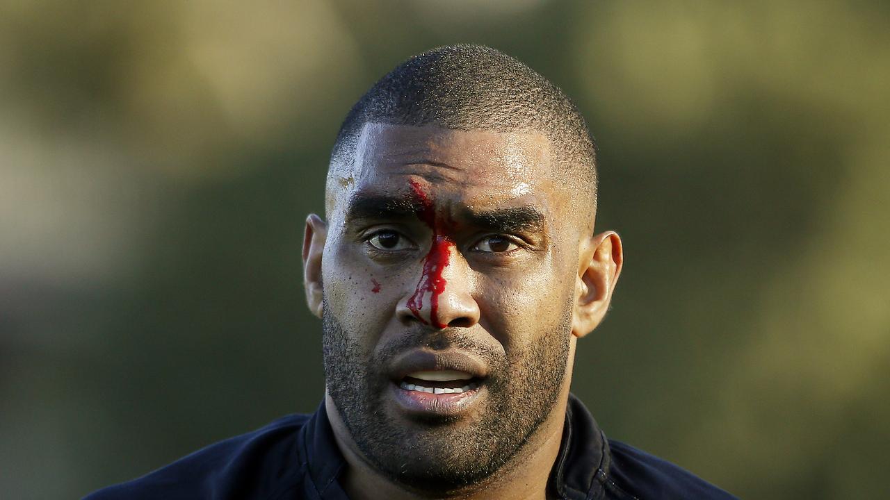 Matraville's Joseph Rokoqo leaves the field bleeding. Picture: John Appleyard