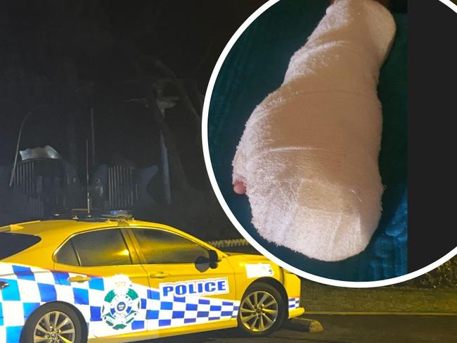 A 16-year-old boy had his finger partially amputated during an alleged wounding attack in Bargara, near Bundaberg.