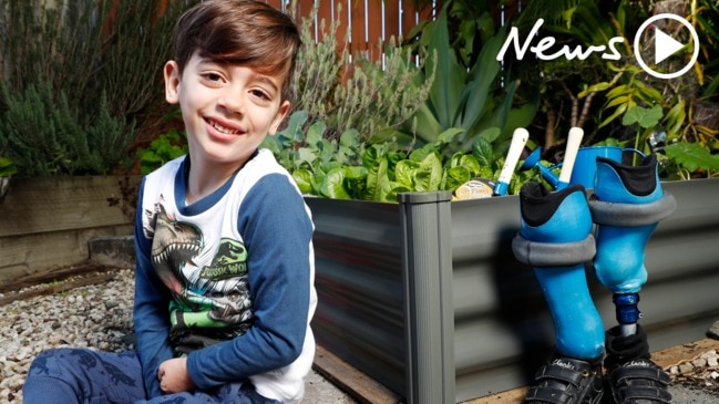 Meet the boy who survived meningococcal