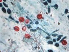 The disease has been identified as cryptosporidiosis, which is caused by a tiny parasite that enters the human body leads to symptoms like nausea, stomach pain, diarrhoea, and loss of appetite. Photo: TN Department of Health