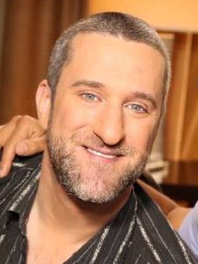 What Dustin Diamond looks like now.