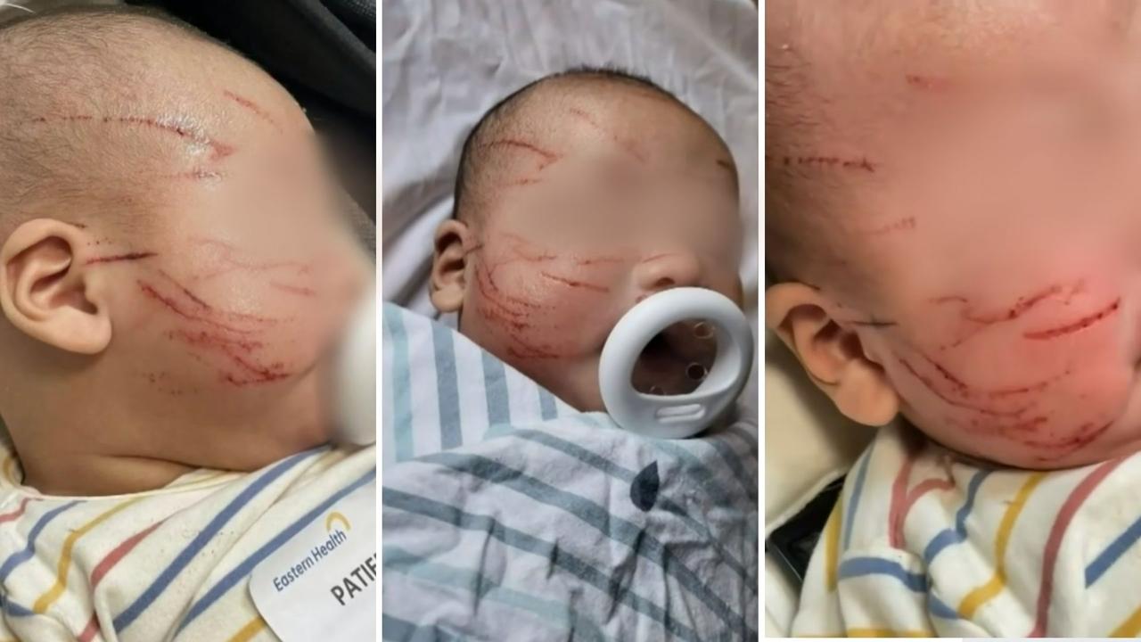 Baby clawed 20 times in childcare attack