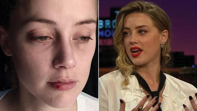 Amber Heard with injuries she says were sustained by a headbutt from Johnny Depp, left, and hours later appearing on James Corden, right. Pictures: Supplied/CBS/YouTube