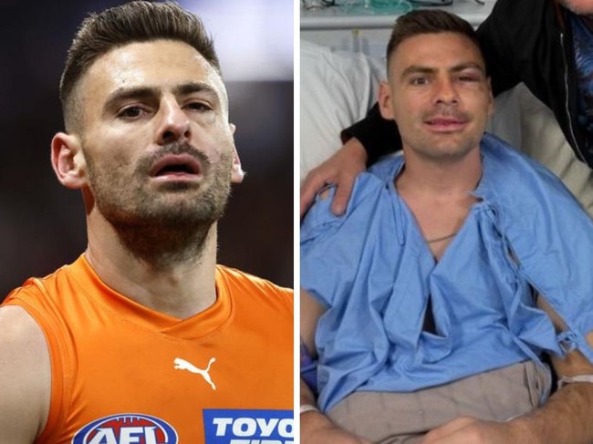 Stephen Coniglio after his postseason surgeries.