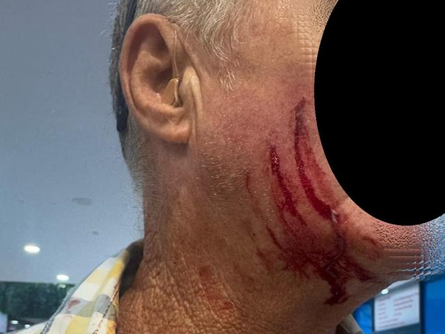 Shocking images have surfaced from Nerang where a young male allegedly attacked an elderly man at knifepoint. Picture: Facebook