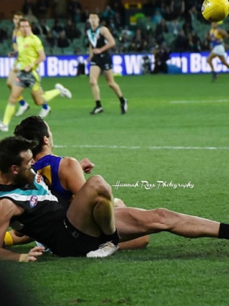 Port Adelaide’s Charlie Dixon breaks his leg last year. Picture: Hannah Rose Photography / Instagram