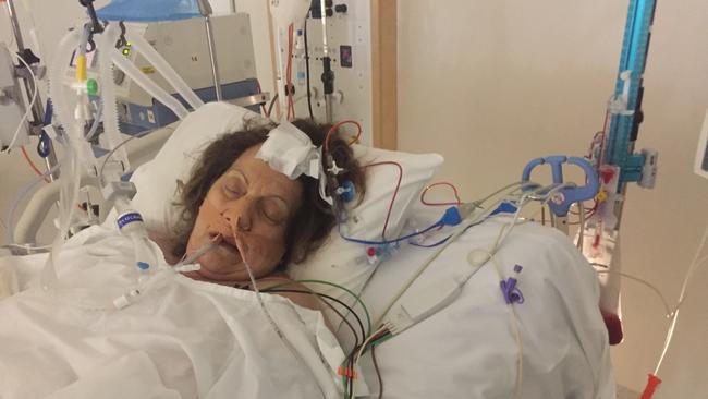 Maria Venuti after her stroke in the intensive care unit.