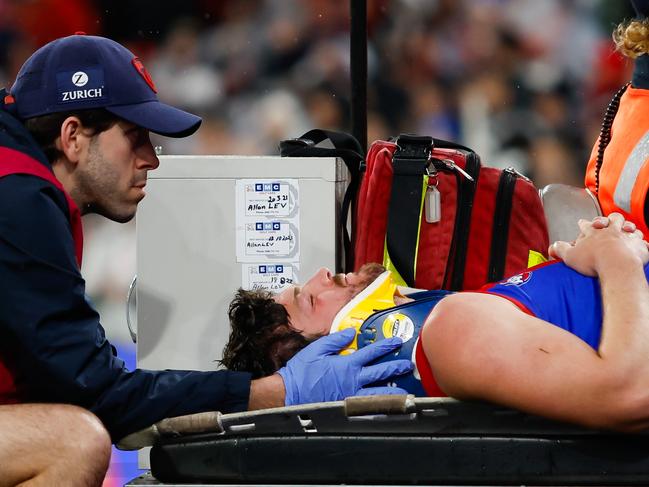 Angus Brayshaw was forced to retire due to his repeated concussions. Picture: Getty Images