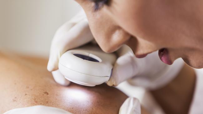 FNQH Skin Cancer Centre lost its federal government incentives, amounting to $100,000, after not qualifying as a general practice, because it performs primarily dermatology and skin cancer procedure.