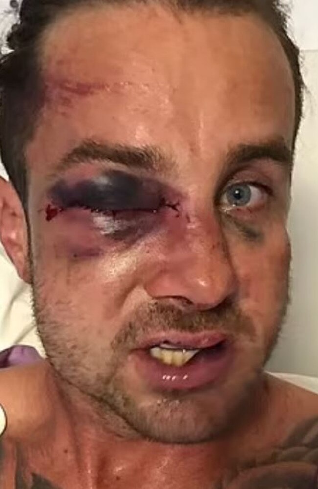 Brisbane father Josh Jones, who was left hospitalised after being allegedly assaulted at a junior rugby league game.