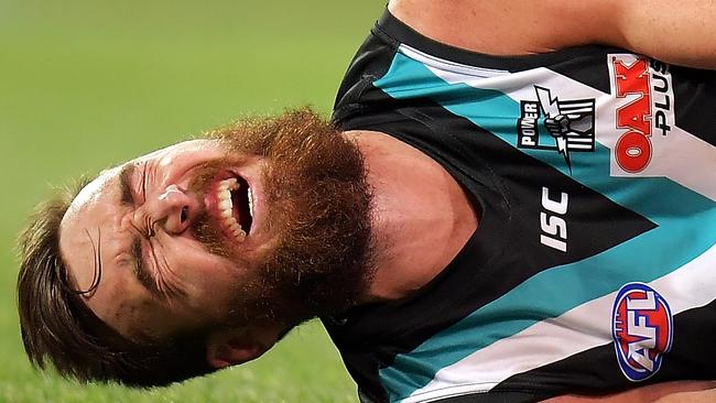 Dixon is attended to by a trainer after falling awkwardly during the round 21 AFL match between the Port Adelaide Power and the West Coast Eagles at Adelaide Oval on August 11, 2018. Photo by Daniel Kalisz/Getty Images.