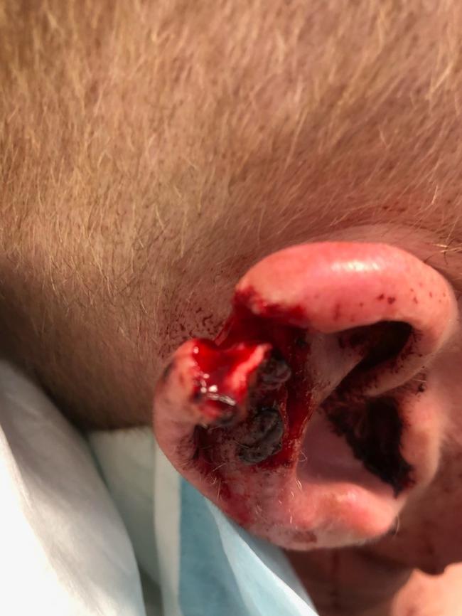 GRAPHIC WARNING: A South Lismore man has accused of biting the ear of an off-duty police officer, leaving him with significant injuries.