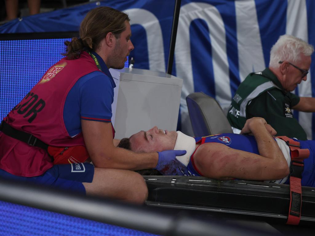 Luke Cleary of the Bulldogs is taken from the ground on a stretcher after a contest with Jackson Archer. Picture: Daniel Pockett/Getty Images)