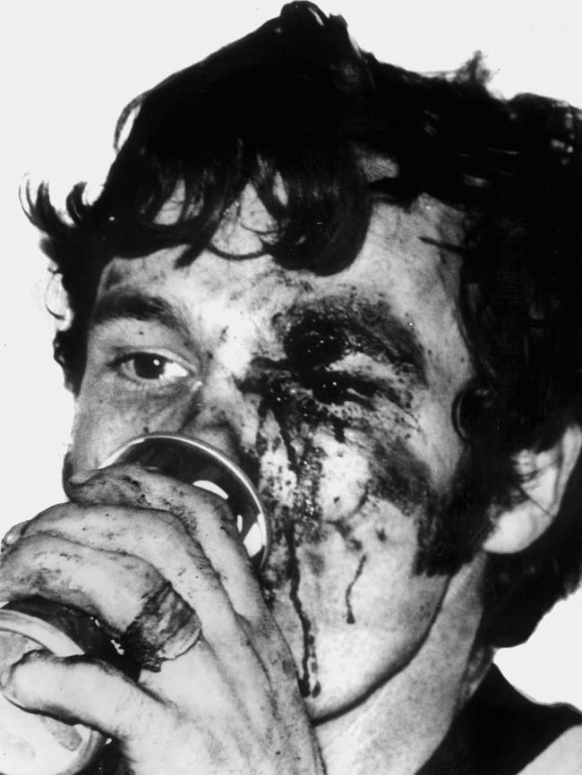 A bloodied Francis Bourke.