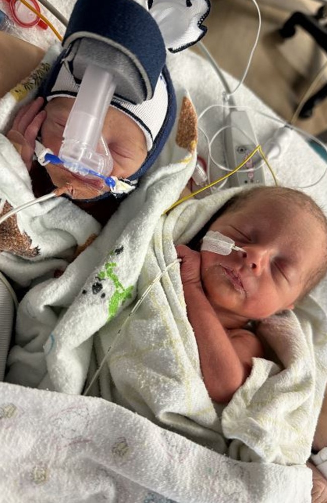 Life-saving surgery and a hospital stay was how twins Lucy and Lilly spent the first months of life. Picture: Contributed