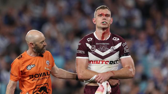 SYDNEY, AUSTRALIA - AUGUST 30: Tom Trbojevic of the Sea Eagles is assisted by a trainer after an injury and a head cut during the round 26 NRL match between Canterbury Bulldogs and Manly Sea Eagles at Accor Stadium on August 30, 2024, in Sydney, Australia. (Photo by Cameron Spencer/Getty Images)