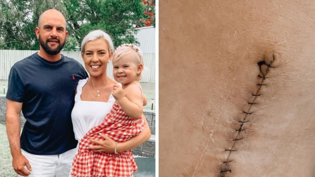 Mum’s shock skin cancer diagnosis