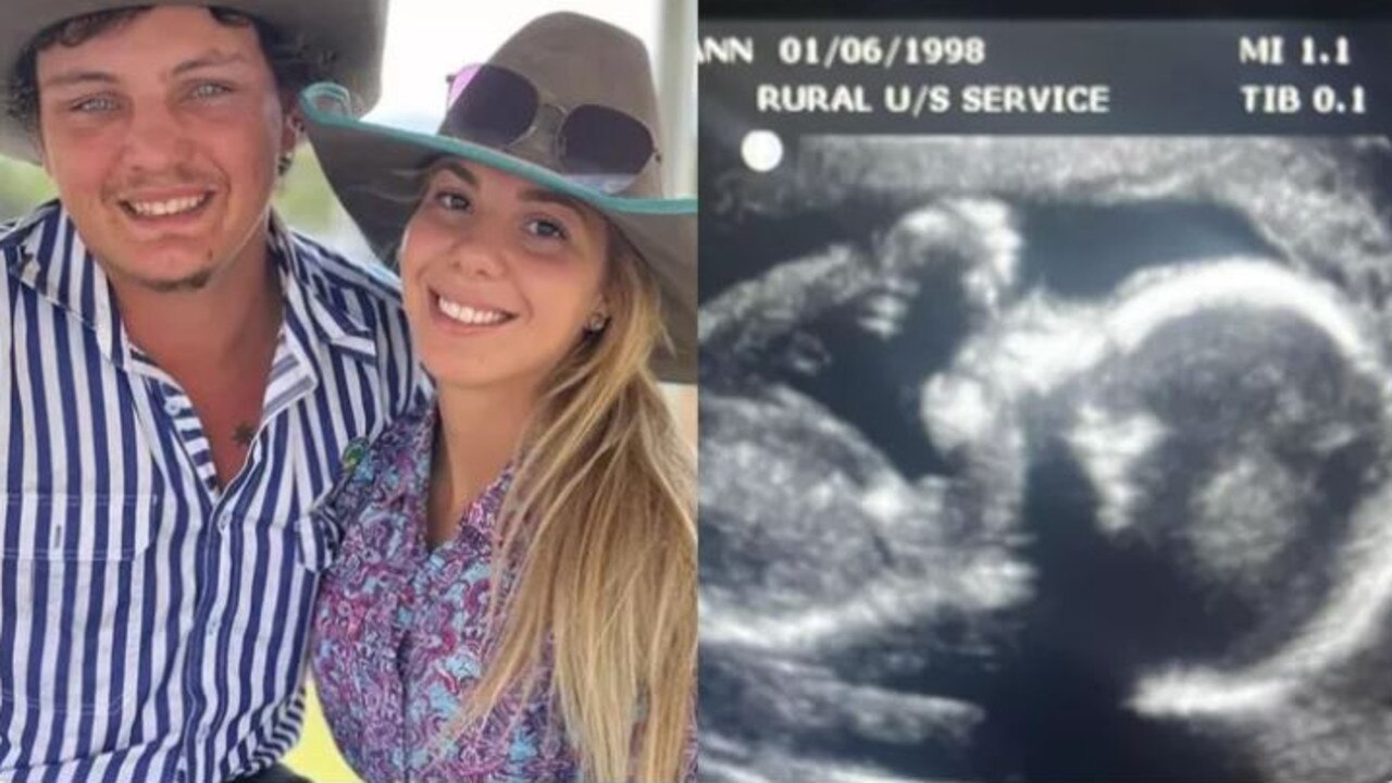Rhiley’s sister shared this photo of the couple. Maree was due to give birth in June to a baby girl they were planning to name Phoebe. Picture: GoFundMe