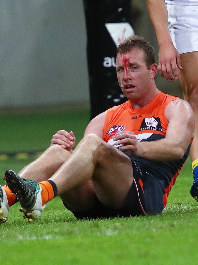 Steve Johnson had his head split open after colliding with Rhys Palmer. Picture: Phil Hillyard