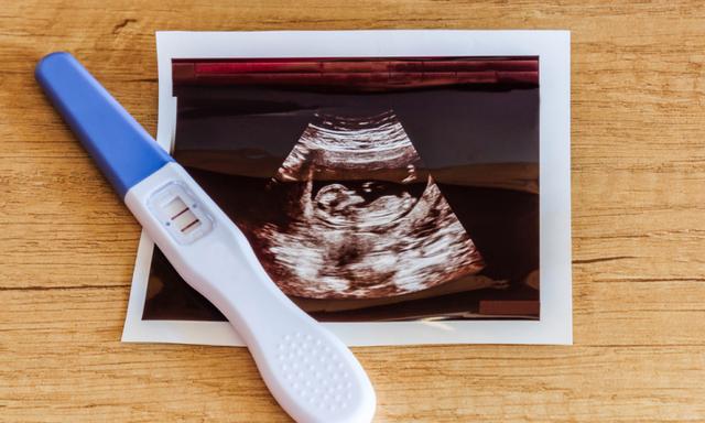 Pregnancy test showing a positive result and ultrasound image isolated on wooden background.
