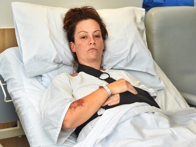 Michelle Nash was left with dozens of broken bones when a car smashed into her and seven children. Picture: Tony Gough