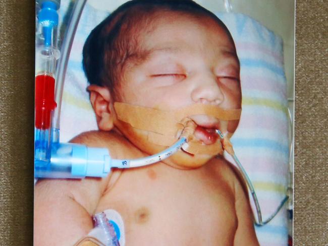 One of the few photos of baby Duaa before her life support was switched off at Liverpool Hospital in 2005.