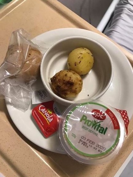 A patient shared this picture of a vegan meal consisting mostly of two potatoes. Picture: Supplied