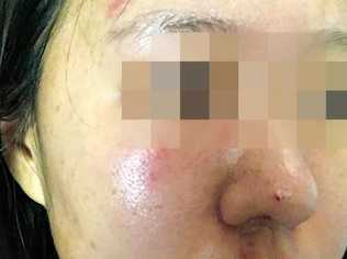 A woman has spoken out after a sickening attack in Bundaberg.