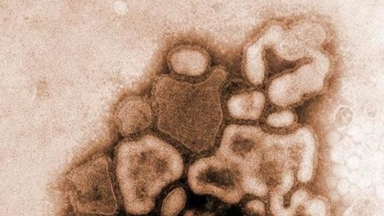 Microscope view of the H1N1 influenza (flu) strain virus. Virus also known as swine flu 04 Mar 2009.