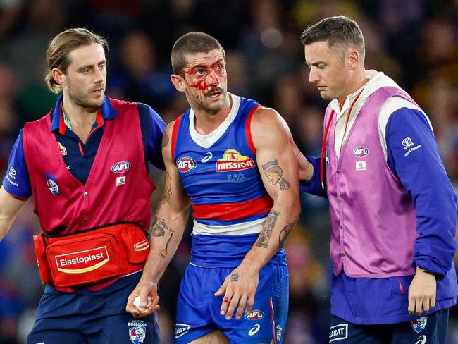 MELBOURNE, AUSTRALIA - MAY 05: Tom Liberatore of the Bulldogs leaves the field under the blood rule during the 2024 AFL Round 08 match between the Western Bulldogs and the Hawthorn Hawks at Marvel Stadium on May 05, 2024 in Melbourne, Australia. (Photo by Dylan Burns/AFL Photos via Getty Images)