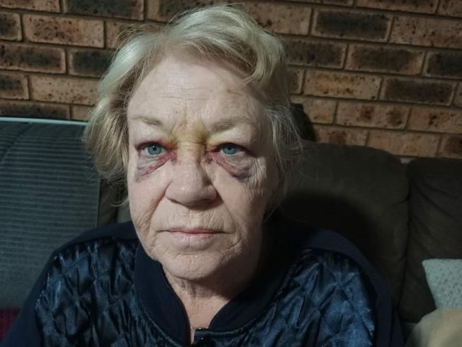 It took months for Christine Smith to recover from the violent attack. Picture: Supplied