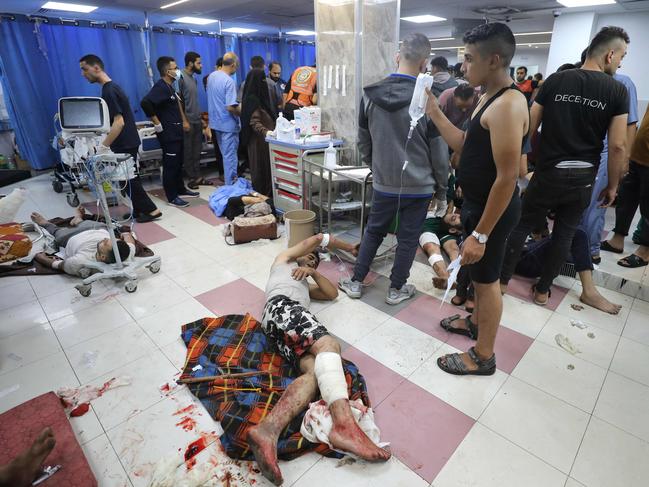 Wounded Palestinians at the Al-Shifa Hospital in Gaza City. Picture: Dawood Nemer/AFP