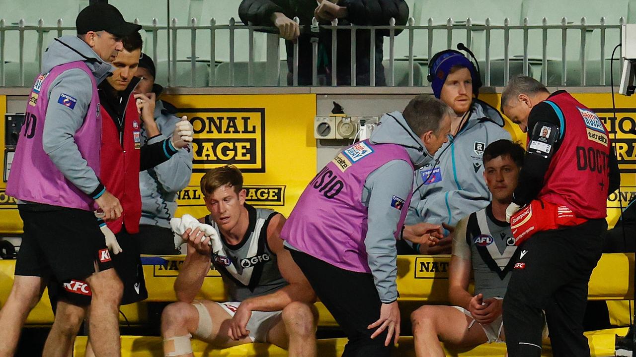 Tom Jonas (left) and Zak Butters of the Power receive medical attention during the 2022 AFL Round 13 match between the Richmond Tigers and the Port Adelaide Power. Picture: Michael Willson/AFL Photos via Getty Images