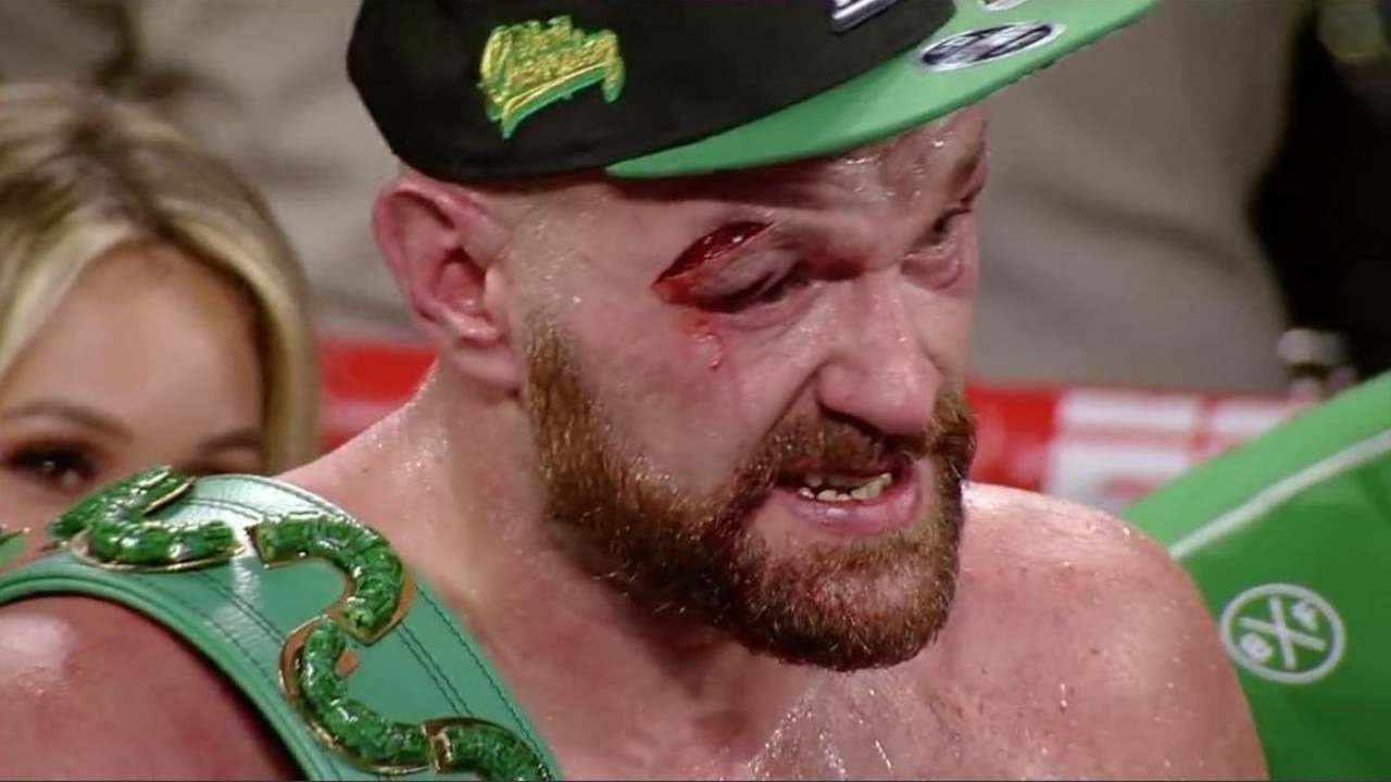 Tyson Fury was left with this disgusting cut from his win over Otto Wallin.