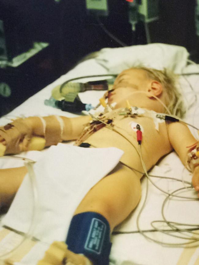 Bachelorette intruder Ryan as a young child after heart surgery.