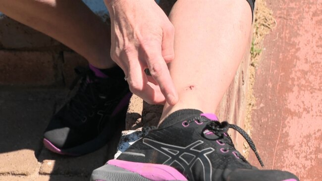 Tracey was rushed to hospital to treat her bite. Picture: 7News